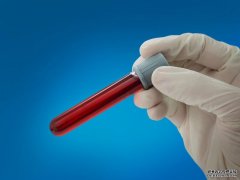 <b>沭鸣平台登陆简单的血液检测如何能彻底改变癌症治疗</b>